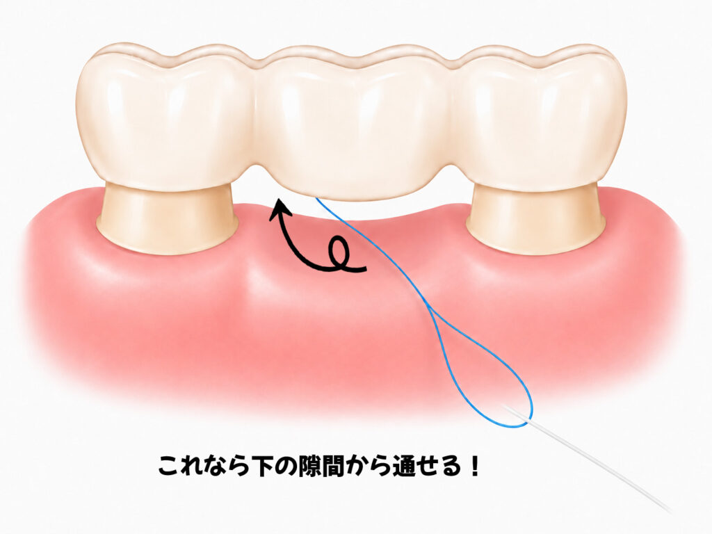 ブリッジの下にスレッダーを通す様子を表したイラスト。